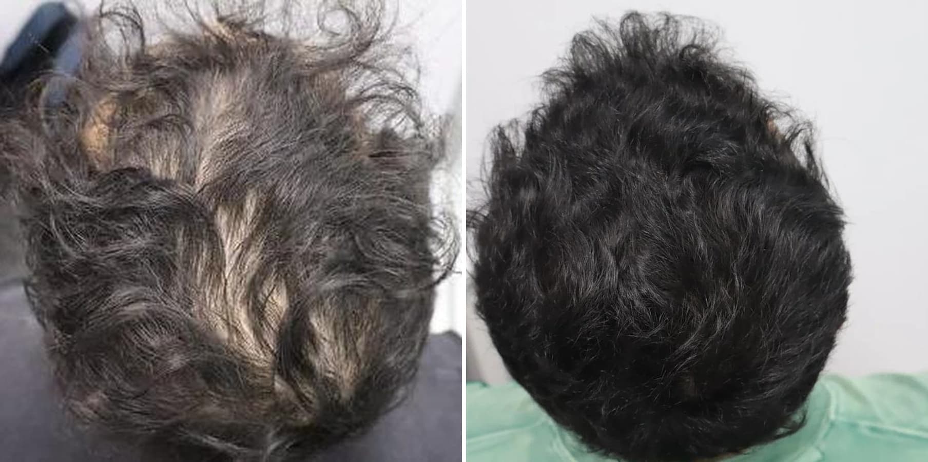 Patient result — 14 months of treatment