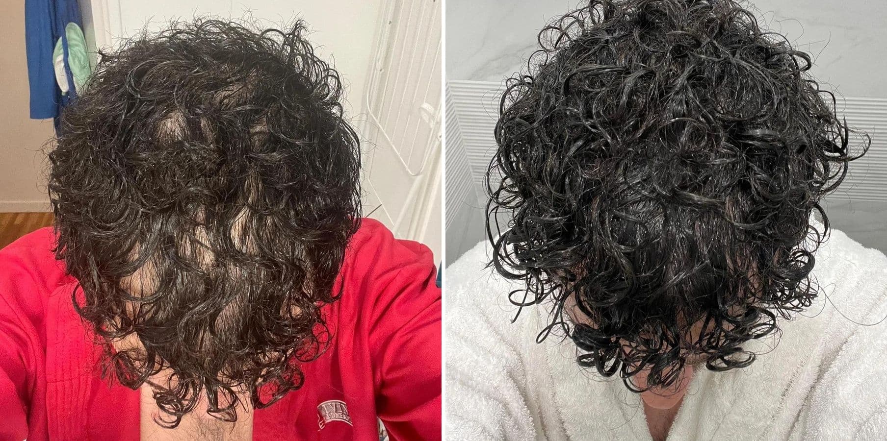 Patient result — 18 months of treatment