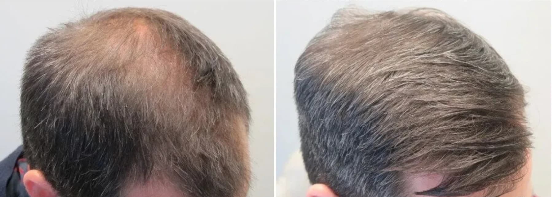 Patient result — 9 months of treatment