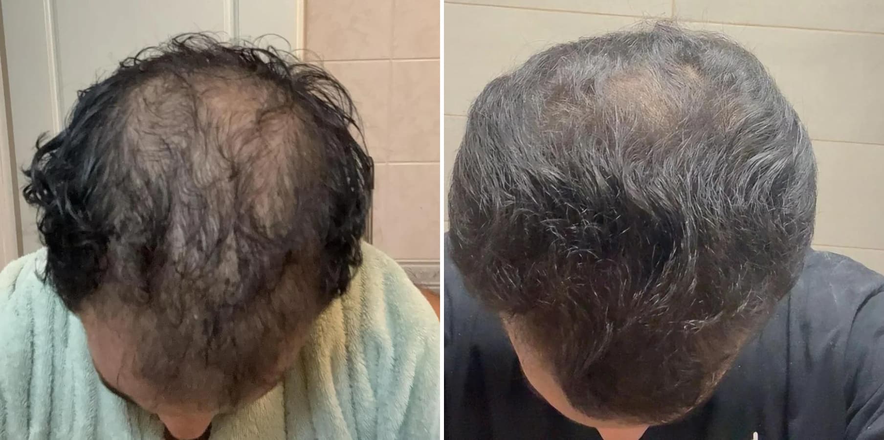 Patient result — 17 months of treatment