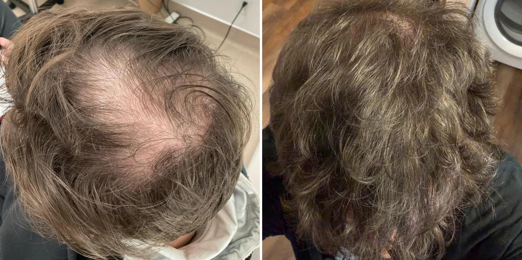 Patient result — 12 months of treatment