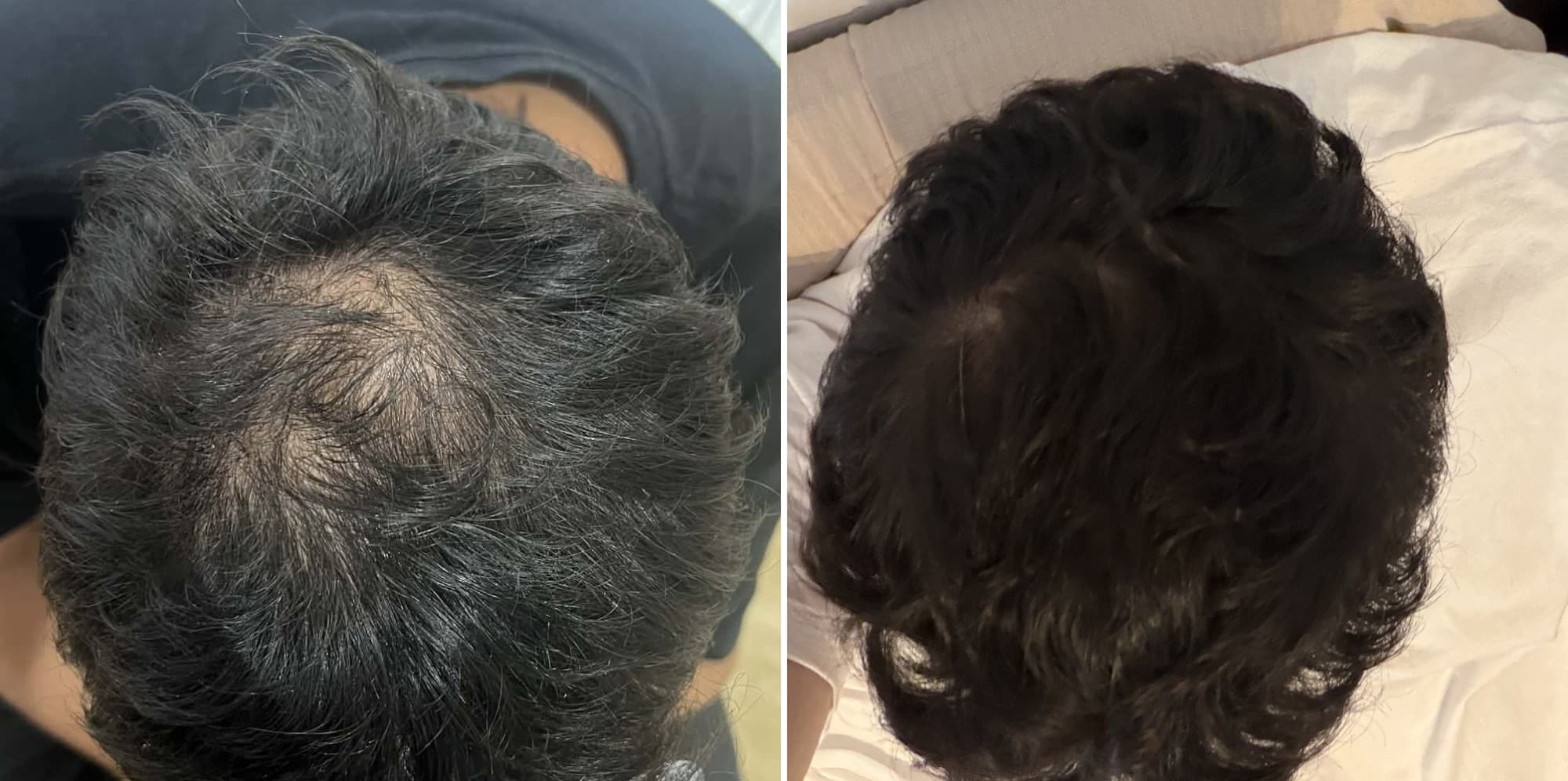 Patient result — 7 months of treatment