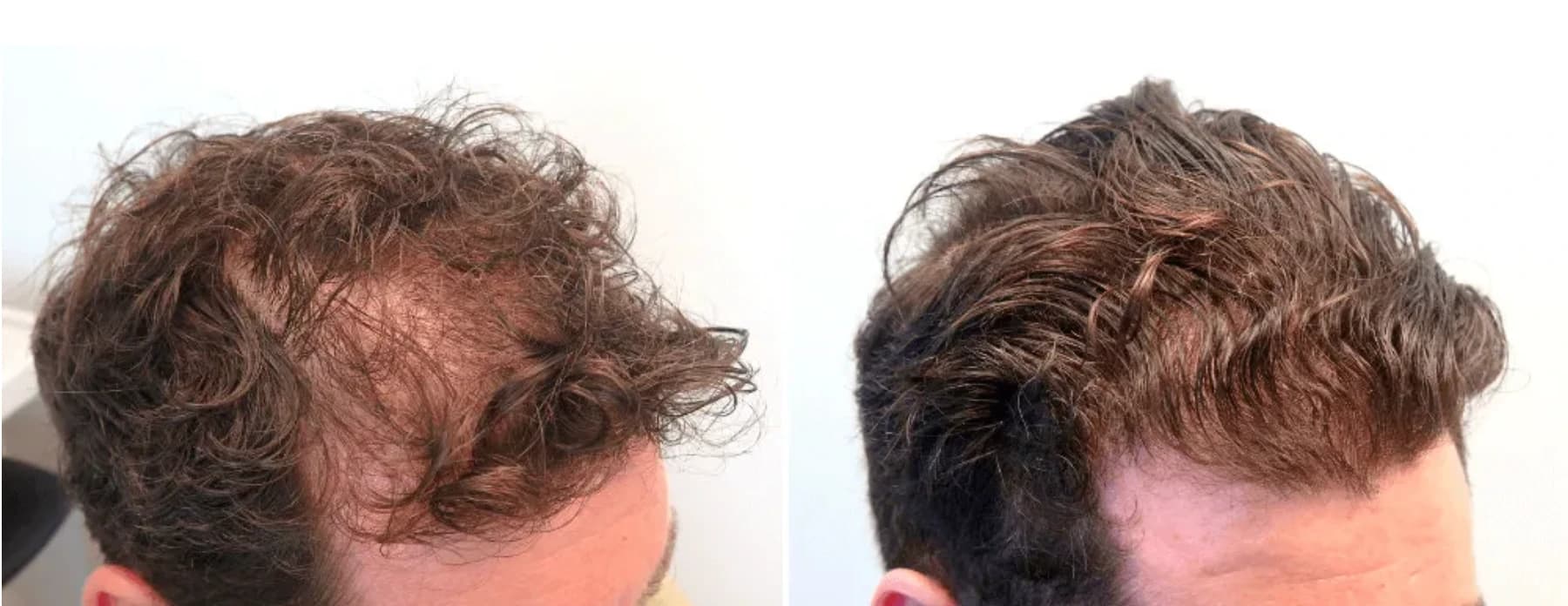 Patient result — 15 months of treatment