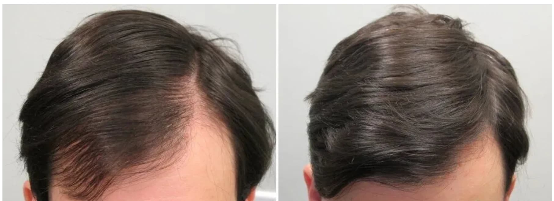 Patient result — 10 months of treatment